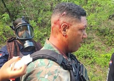 Foto herido en marcha en el Sur